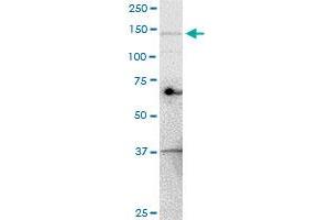 UBE4A monoclonal antibody (M08), clone 1G8. (UBE4A anticorps  (AA 974-1073))