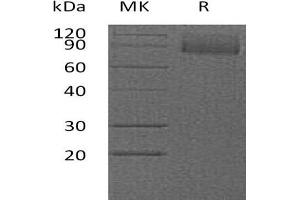 Western Blotting (WB) image for CD36 (CD36) protein (His tag,AVI tag) (ABIN7320864)