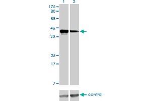 Western blot analysis of CCNK over-expressed 293 cell line, cotransfected with CCNK Validated Chimera RNAi (Lane 2) or non-transfected control (Lane 1).