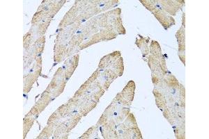 Immunohistochemistry of paraffin-embedded Mouse heart using ATAD3B Polyclonal Antibody at dilution of 1:100 (40x lens). (ATAD3B anticorps)
