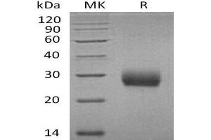 Western Blotting (WB) image for Tumor Necrosis Factor Receptor Superfamily, Member 11a, NFKB Activator (TNFRSF11A) protein (His tag) (ABIN7320633)