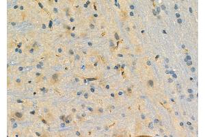 ABIN6261285 and ABIN6276758 at 1/100 staining Rat brain tissue by IHC-P. (Dihydrofolate Reductase anticorps  (N-Term))