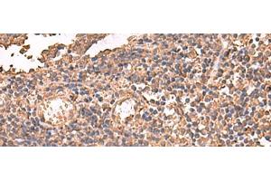 Immunohistochemistry of paraffin-embedded Human tonsil tissue using LDHAL6B Polyclonal Antibody at dilution of 1:65(x200)