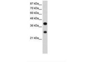 Image no. 2 for anti-Poly(rC) Binding Protein 2 (PCBP2) (AA 191-240) antibody (ABIN203085)