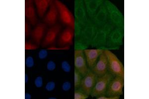 ALS2CR2 Mouse Monoclonal Antibody staining Hela cells by IF/ICC.
