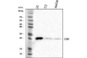 Western blot analysis of CIB1 using anti-CIB1 antibody (ABIN3042748).