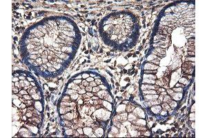 Immunohistochemical staining of paraffin-embedded Human colon tissue using anti-TUBAL3 mouse monoclonal antibody. (TUBAL3 anticorps  (AA 150-446))