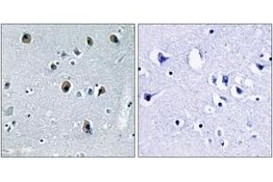 Immunohistochemistry (IHC) image for anti-Collagen, Type XX, alpha 1 (COL20A1) (AA 1151-1200) antibody (ABIN2889927)