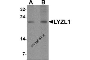 Western Blotting (WB) image for anti-Lysozyme-Like 1 (LYZL1) (N-Term) antibody (ABIN1587946) (Lysozyme-Like 1 anticorps  (N-Term))