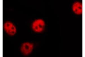 ABIN6267528 staining 293 by IF/ICC. (SAPK, JNK (pThr183) anticorps)