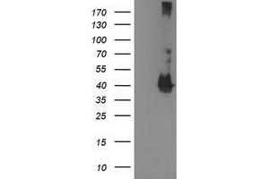 Western Blotting (WB) image for anti-Microtubule-Associated Protein, RP/EB Family, Member 2 (MAPRE2) antibody (ABIN1499317) (MAPRE2 anticorps)