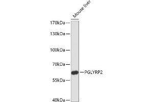Western blot analysis of extracts of Mouse liver, using PGLYRP2 antibody (ABIN7269206) at 1:1000 dilution.