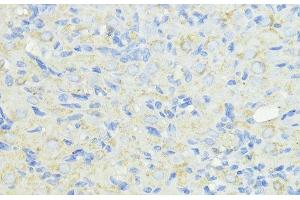 Immunohistochemistry of paraffin-embedded Rat ovary using CTSB Polyclonal Antibody at dilution of 1:100 (40x lens). (Cathepsin B anticorps)