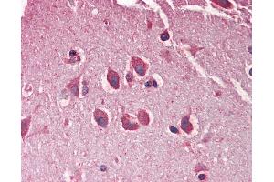 Anti-MXRA5 antibody IHC staining of human brain, cortex. (Adlican anticorps  (AA 1454-1467))