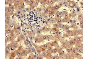 Immunohistochemistry of paraffin-embedded human liver tissue using ABIN7161618 at dilution of 1:100 (NIPBL anticorps  (AA 2523-2697))