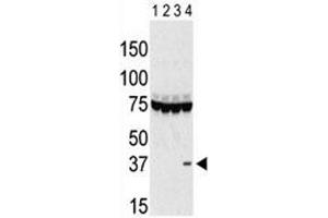 Western blot testing of Aurora-C antibody and lysate of 293 cells expressing 1) Flag tag, 2) Flag-tagged -A, 3) -B and 4) Aurora-C.