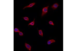 ABIN6266223 and ABIN6277374 staining HepG2 by IF/ICC. (Gelsolin anticorps  (C-Term))