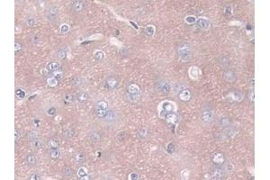 Detection of ANGPT1 in Rat Cerebrum Tissue using Polyclonal Antibody to Angiopoietin 1 (ANGPT1)