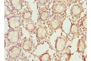 Immunohistochemistry of paraffin-embedded human colon tissue using ABIN7142076 at dilution of 1:100 (RDH5 anticorps  (AA 24-318))