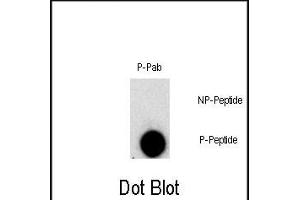 Dot blot analysis of Phospho-FGFR1- polyclonal antibody `a on nitrocellulose membrane. (FGFR1 anticorps  (pTyr307))