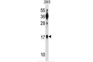 BATF Antibody (N-term) western blot analysis in 293 cell line lysates (35µg/lane).