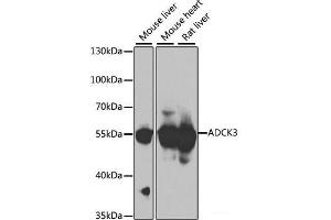 Western blot analysis of extracts of various cell lines using ADCK3 Polyclonal Antibody at dilution of 1:1000. (COQ8A anticorps)