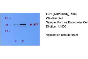 Western Blotting (WB) image for anti-Friend Leukemia Virus Integration 1 (FLI1) (N-Term) antibody (ABIN183608) (FLI1 anticorps  (N-Term))