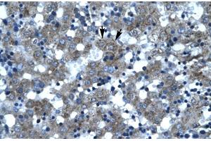 Rabbit Anti-SUPT3H Antibody Catalog Number: ARP30038 Paraffin Embedded Tissue: Human Liver Cellular Data: Hepatocytes Antibody Concentration: 4. (SUPT3H/SPT3 anticorps  (N-Term))
