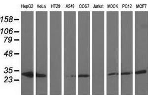Western blot analysis of extracts (35 µg) from 9 different cell lines by using anti-AK3 monoclonal antibody. (Adenylate Kinase 3 anticorps)