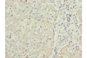 Immunohistochemistry of paraffin-embedded human liver tissue using ABIN7143435 at dilution of 1:100