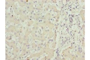 Immunohistochemistry of paraffin-embedded human liver tissue using ABIN7143435 at dilution of 1:100 (ADPGK anticorps  (AA 218-497))