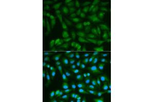 Immunofluorescence analysis of MCF-7 cells using SORD antibody.