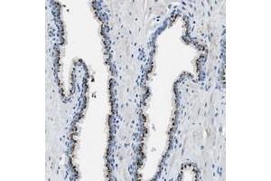 Immunohistochemical staining of human prostate with C16orf79 polyclonal antibody  shows strong cytoplasmic positivity, with a granular pattern, in glandular cells. (BRICD5 anticorps)