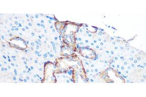 Immunohistochemistry of paraffin-embedded Mouse kidney using YTHDF2 Polyclonal Antibody at dilution of 1:100 (40x lens). (YTHDF2 anticorps)