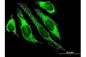 Immunofluorescence of purified MaxPab antibody to PDHB on HeLa cell.