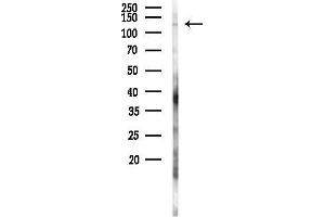 Western blot analysis of lysates from PC12 cells(LPS 4h treatment), using FBLN2 Antibody at 1/1000 dilution.