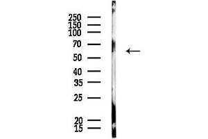 anti-Acrosin Binding Protein (ACRBP) (Internal Region) antibody
