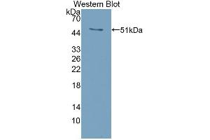 Detection of Recombinant RANkL, Mouse using Polyclonal Antibody to Receptor Activator Of Nuclear Factor Kappa B Ligand (RANkL) (RANKL anticorps  (AA 92-263))