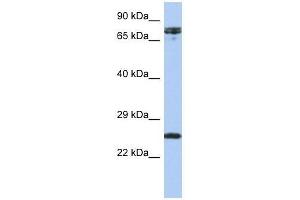 HNF1A antibody used at 0.