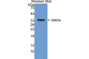 Detection of Recombinant IGFBP5, Mouse using Polyclonal Antibody to Insulin Like Growth Factor Binding Protein 5 (IGFBP5) (IGFBP5 anticorps  (AA 25-271))