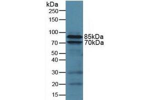 Detection of CD18 in Human U937 Cells using Polyclonal Antibody to Integrin Beta 2 (CD18)