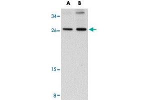 Western blot analysis of SCAMP4 in NIH/3T3 cell lysate with SCAMP4 polyclonal antibody  at (A) 1 and (B) 2 ug/mL .