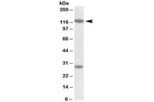 Western blot testing of MOLT4 lysate with UBN1 antibody at 1ug/ml. (Ubinuclein 1 anticorps)