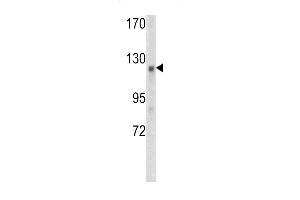 Western blot analysis of WTX antibody (Center) (ABIN390467 and ABIN2840835) in mouse kidney tissue lysates (35 μg/lane).