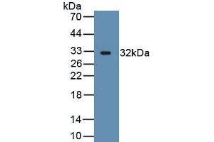 Detection of Recombinant ACTN3, Human using Polyclonal Antibody to Actinin Alpha 3 (ACTN3) (ACTN3 anticorps  (AA 162-416))