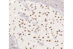 Immunohistochemistry analysis of paraffin-embedded rat brain using,SNRPD2 (ABIN7075634) at dilution of 1: 1600 (SNRPD2 anticorps)