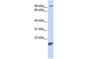 Image no. 1 for anti-Immature Colon Carcinoma Transcript 1 (ICT1) (AA 108-157) antibody (ABIN6743781) (ICT1 anticorps  (AA 108-157))