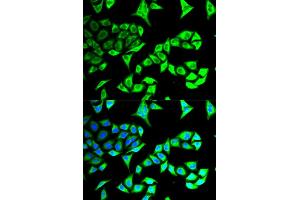 Immunofluorescence analysis of MCF-7 cells using GABARAP antibody (ABIN5973270). (GABARAP anticorps)