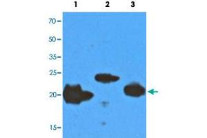 Western blot analysis with recombinant protein (200 ng) of NRAS (Lane 1), KRAS (Lane 2) and HRAS (Lane 3). (GTPase NRas anticorps)