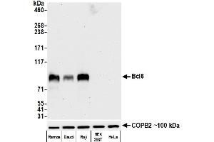 Western Blotting (WB) image for anti-B-Cell CLL/lymphoma 6 (BCL6) (AA 375-425) antibody (ABIN7455109)